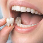 Person with tooth pain holding jaw