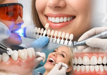 10 Examples of Cosmetic Dentistry