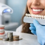Professional Teeth Whitening Cost Explained