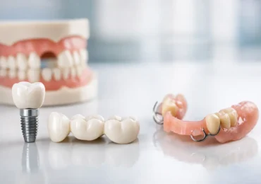Best Options for Missing Teeth Explained