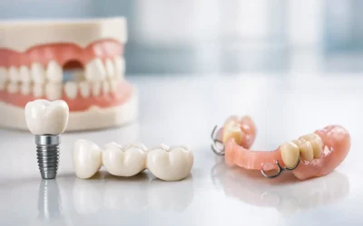 Best Options for Missing Teeth Explained