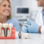 Dental Implants: What to Expect