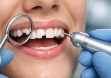 How to Fix Chipped Tooth Damage Fast
