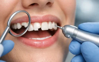 How to Fix Chipped Tooth Damage Fast