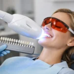 Professional Teeth Whitening Review