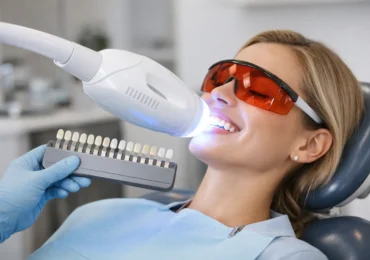 Professional Teeth Whitening Review
