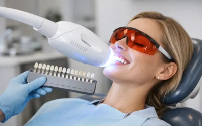 Professional Teeth Whitening Review