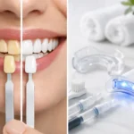 How to Whiten Stained Teeth Without Guesswork