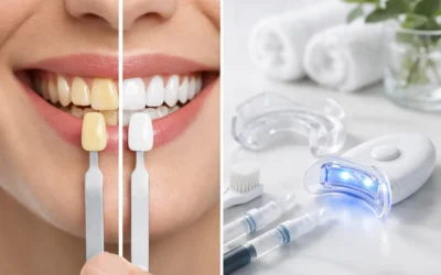 How to Whiten Stained Teeth Without Guesswork