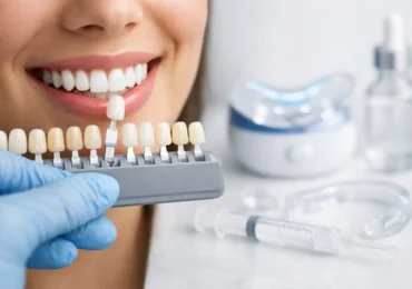 How to Whiten Teeth Safely Without Damage