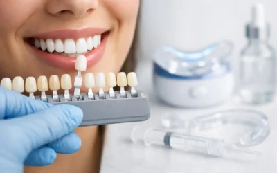 How to Whiten Teeth Safely Without Damage
