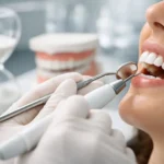 How Often Should Teeth Be Cleaned? A Clear Answer