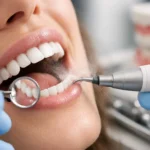 What Does Deep Cleaning Do for Teeth and Gums?