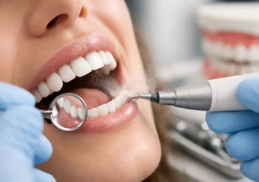 What Does Deep Cleaning Do for Teeth and Gums?
